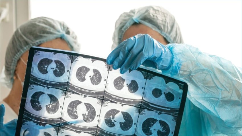 24 martie – Ziua Mondială de Luptă Împotriva Tuberculozei. Campanie națională de informare și Arcul de Triumf iluminat în roșu