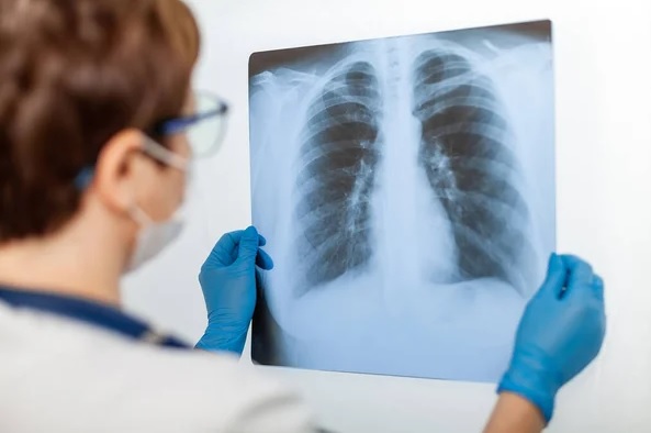 Campania „Inspiră Speranța – Pune Întrebarea Potrivită” spulberă prejudecățile în cancerul pulmonar