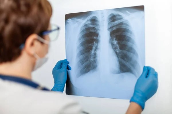 Prima campanie pentru depistarea timpurie a bolilor pulmonare se încheie
