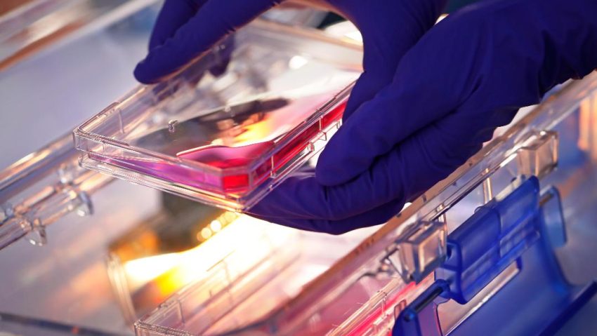 Progres în tratamentul cancerului de prostată în România