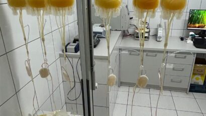 Premieră națională! CTSMB introduce un nou component sanguin